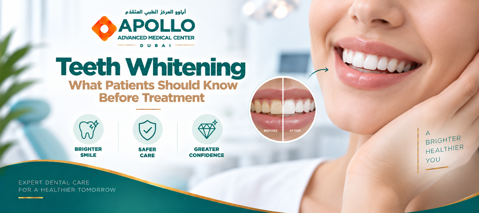 Teeth Whitening: What Patients Should Know Before Treatment