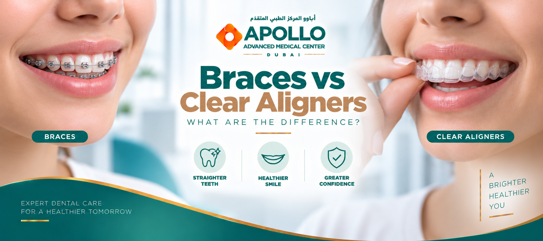 Braces vs Clear Aligners: What Are the Differences?