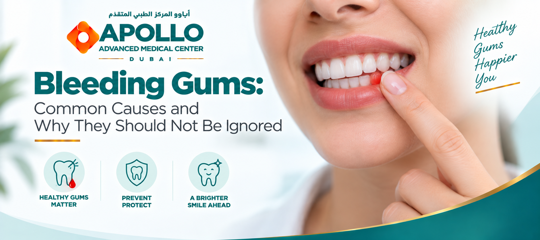 Bleeding Gums: Common Causes and Why They Should Not Be Ignored