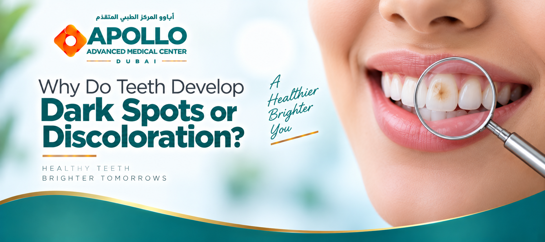 Why Do Teeth Develop Dark Spots or Discoloration?