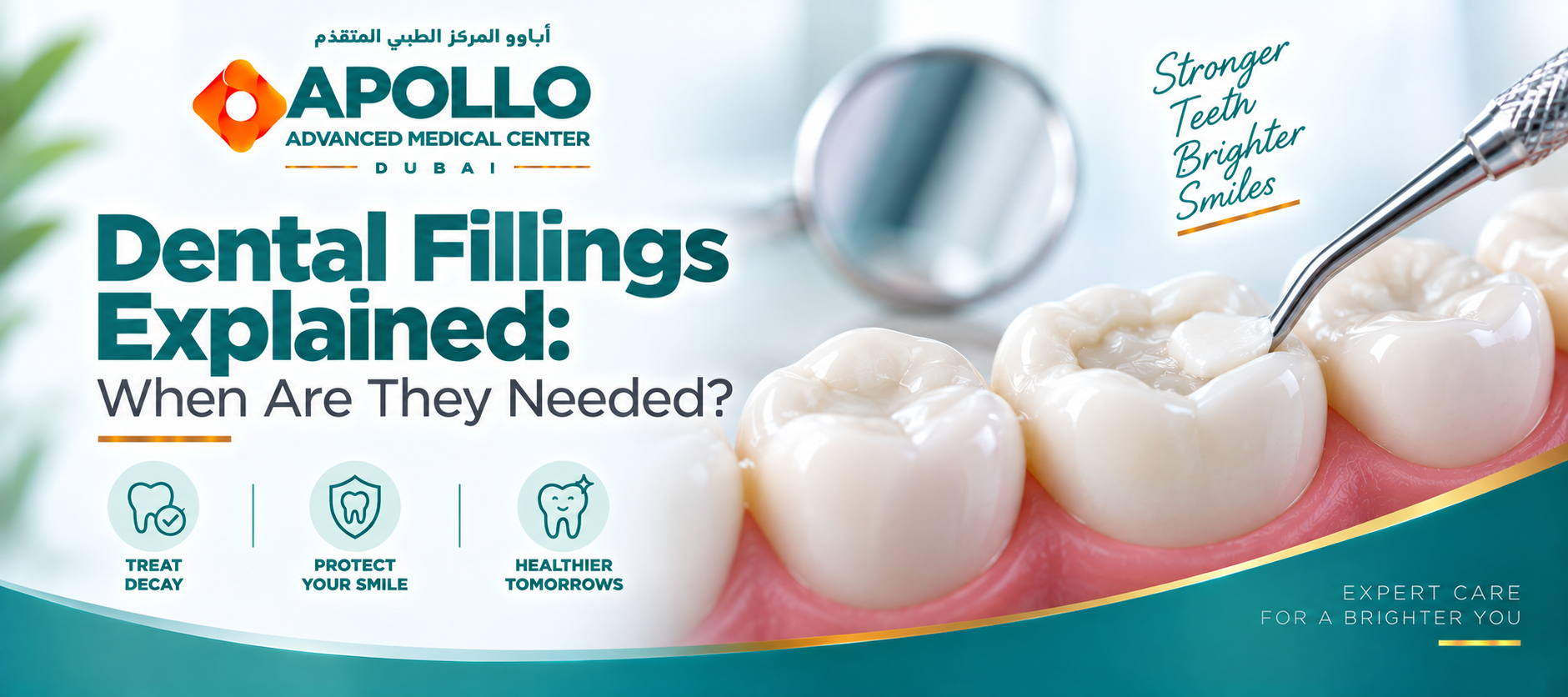 Dental Fillings Explained: When Are They Needed?