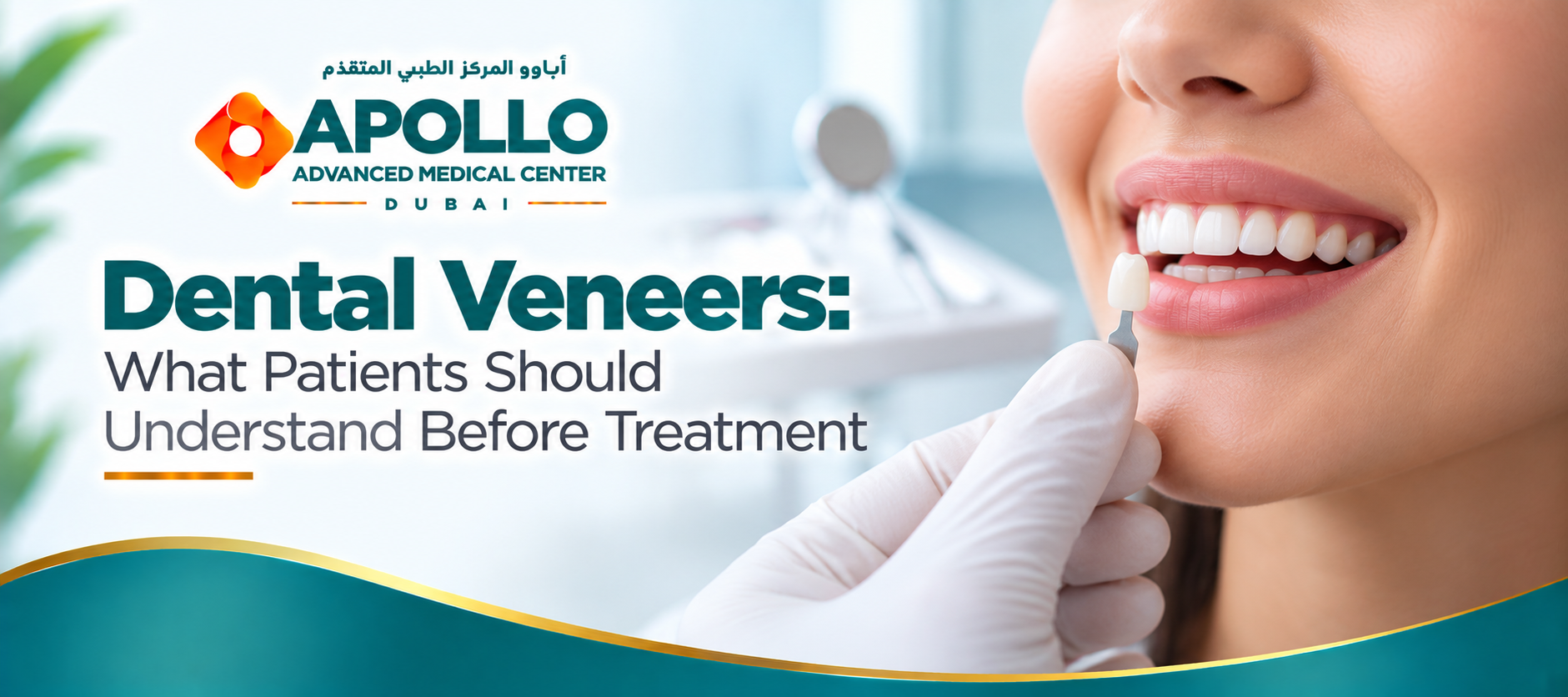 Dental Veneers: What Patients Should Understand Before Treatment
