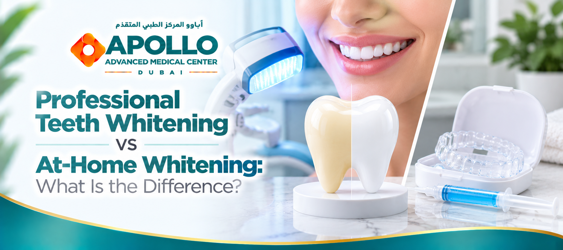 Professional Teeth Whitening vs At-Home Whitening: What Is the Difference?
